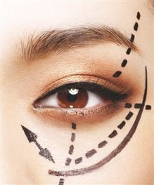 美微儿meiver培训学校 埋线双眼皮 自信女人最