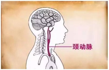 颈动脉!
